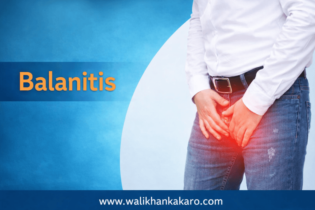 Balanitis